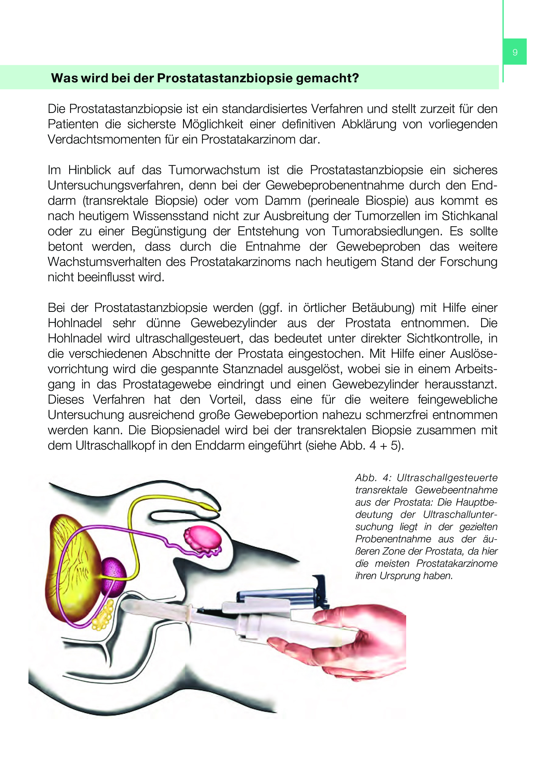 Die Prostatastanzbiopsie Gewebeentnahme aus der Prostata Prostata.de